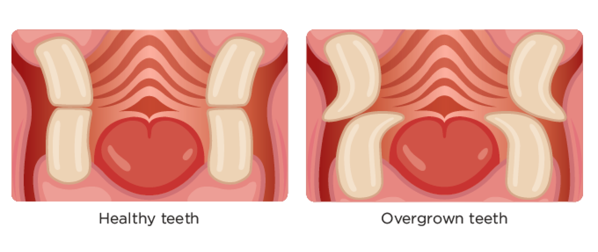 A side-by-side anatomical illustration showing "Healthy teeth" with properly aligned molars on the left, and "Overgrown teeth" with elongated, curved molars on the right.